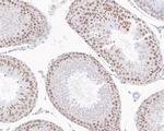 USP39 Antibody in Immunohistochemistry (Paraffin) (IHC (P))