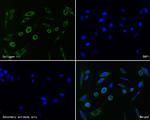 Collagen III Antibody in Immunocytochemistry (ICC/IF)
