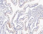GBP1 Antibody in Immunohistochemistry (Paraffin) (IHC (P))