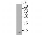 CTNNBIP1 Antibody in Western Blot (WB)