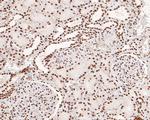 PDCD7 Antibody in Immunohistochemistry (Paraffin) (IHC (P))