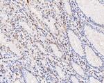 PDCD7 Antibody in Immunohistochemistry (Paraffin) (IHC (P))