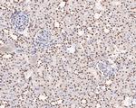 PDCD7 Antibody in Immunohistochemistry (Paraffin) (IHC (P))