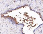 ACAT2 Antibody in Immunohistochemistry (Paraffin) (IHC (P))