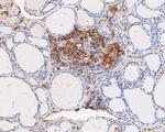 ARPC2 Antibody in Immunohistochemistry (Paraffin) (IHC (P))