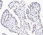 CPSF3 Antibody in Immunohistochemistry (Paraffin) (IHC (P))