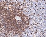 CD7 Antibody in Immunohistochemistry (Paraffin) (IHC (P))