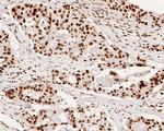 SNRPA1 Antibody in Immunohistochemistry (Paraffin) (IHC (P))