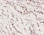 SNRPA1 Antibody in Immunohistochemistry (Paraffin) (IHC (P))