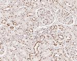 SNRPA1 Antibody in Immunohistochemistry (Paraffin) (IHC (P))