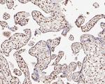 SNRPA1 Antibody in Immunohistochemistry (Paraffin) (IHC (P))