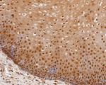 OLIG3 Antibody in Immunohistochemistry (Paraffin) (IHC (P))