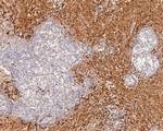 Kappa Light Chain Antibody in Immunohistochemistry (Paraffin) (IHC (P))