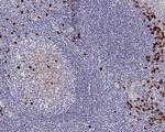 Kappa Light Chain Antibody in Immunohistochemistry (Paraffin) (IHC (P))