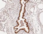 HDGF Antibody in Immunohistochemistry (Paraffin) (IHC (P))