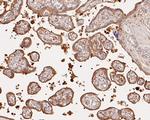 ERLIN2 Antibody in Immunohistochemistry (Paraffin) (IHC (P))