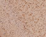 ERLIN2 Antibody in Immunohistochemistry (Paraffin) (IHC (P))