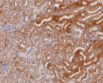 ERLIN2 Antibody in Immunohistochemistry (Paraffin) (IHC (P))