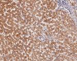 ACAA2 Antibody in Immunohistochemistry (Paraffin) (IHC (P))