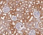 ACAA2 Antibody in Immunohistochemistry (Paraffin) (IHC (P))