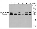 CTR1 Antibody in Western Blot (WB)