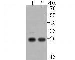 CTR1 Antibody in Western Blot (WB)