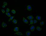 UBE4A Antibody in Immunocytochemistry (ICC/IF)