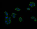 UBE4A Antibody in Immunocytochemistry (ICC/IF)