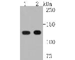 UBE4A Antibody in Western Blot (WB)