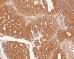 SLC27A4 Antibody in Immunohistochemistry (Paraffin) (IHC (P))