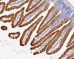 SLC27A4 Antibody in Immunohistochemistry (Paraffin) (IHC (P))