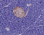 GNAS Antibody in Immunohistochemistry (Paraffin) (IHC (P))