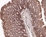 C1QBP Antibody in Immunohistochemistry (Paraffin) (IHC (P))