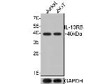 IL10RB Antibody in Western Blot (WB)