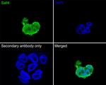 SALL4 Antibody in Immunocytochemistry (ICC/IF)