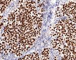 SALL4 Antibody in Immunohistochemistry (Paraffin) (IHC (P))