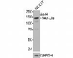 SALL4 Antibody in Western Blot (WB)