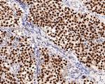 SALL4 Antibody in Immunohistochemistry (Paraffin) (IHC (P))