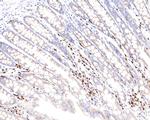 IRF4 Antibody in Immunohistochemistry (Paraffin) (IHC (P))