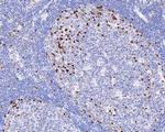 IRF4 Antibody in Immunohistochemistry (Paraffin) (IHC (P))