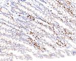 IRF4 Antibody in Immunohistochemistry (Paraffin) (IHC (P))