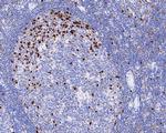 IRF4 Antibody in Immunohistochemistry (Paraffin) (IHC (P))