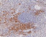 CD42a Antibody in Immunohistochemistry (Paraffin) (IHC (P))