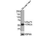 VGLUT1 Antibody in Western Blot (WB)