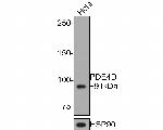 PDE4D Antibody in Western Blot (WB)