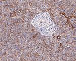 SLC7A11 Antibody in Immunohistochemistry (Paraffin) (IHC (P))