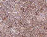 SLC7A11 Antibody in Immunohistochemistry (Paraffin) (IHC (P))