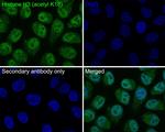 H3K18ac Antibody in Immunocytochemistry (ICC/IF)