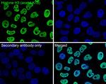 H3K18ac Antibody in Immunocytochemistry (ICC/IF)