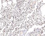 H3K18ac Antibody in Immunohistochemistry (Paraffin) (IHC (P))